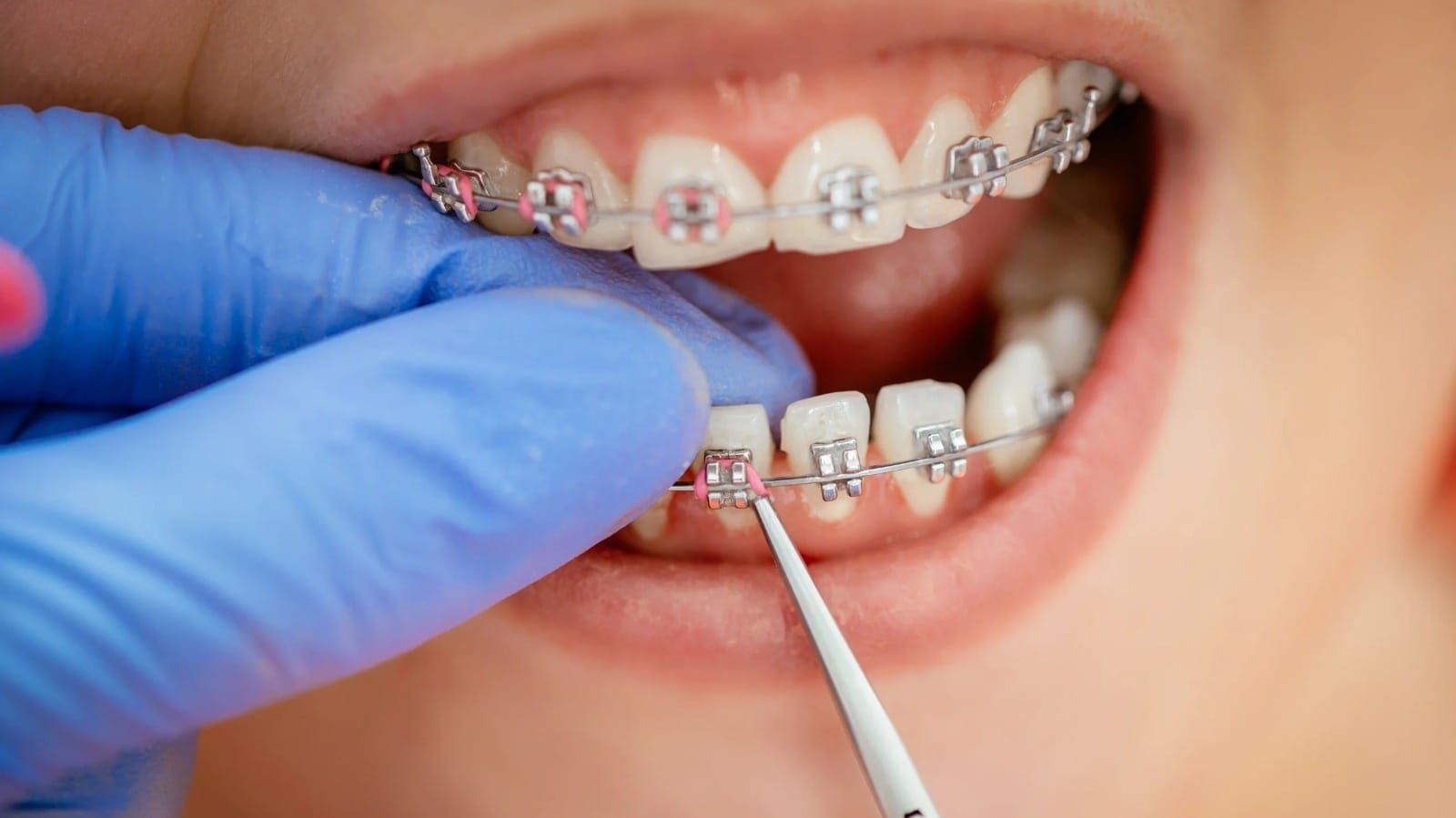 Orthodontics and Dentofacial Orthopedics
